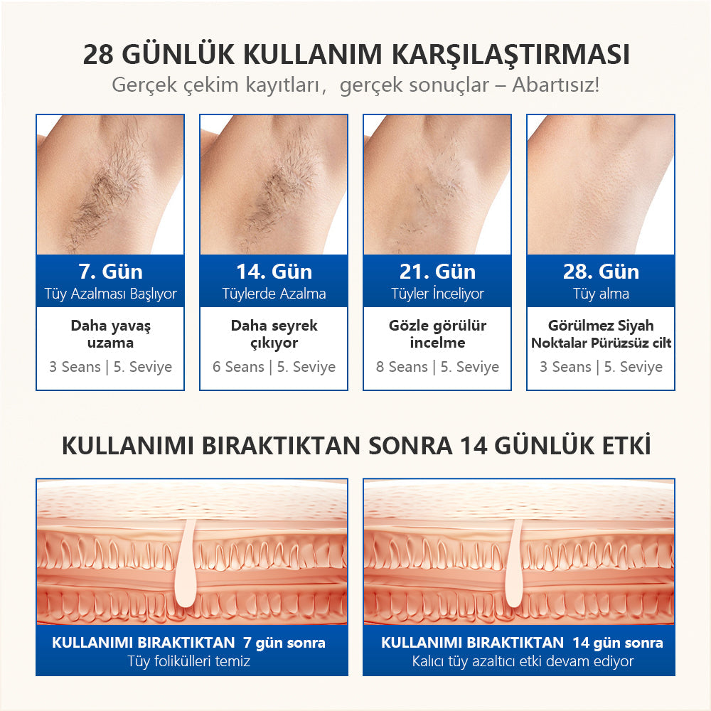 MLAY T16 BiR MİLYON ATIM (4 adet başlık) soğuk otomatik ev epilasyon lazer cihazı
