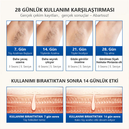 MLAY T16 BiR MİLYON ATIM (4 adet başlık) soğuk otomatik ev epilasyon lazer cihazı