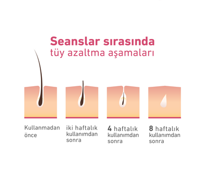 MLAY T14 (tek başlık) yeni nesil buz özelliğiyle İPL lazer epilasyon cihazı